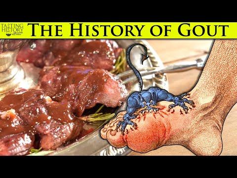 Gout - The Disease of Kings