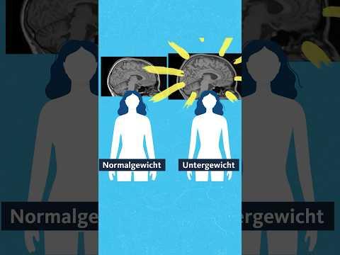 Das macht Magersucht mit deinem Gehirn. #quarks #ernährung #magersucht